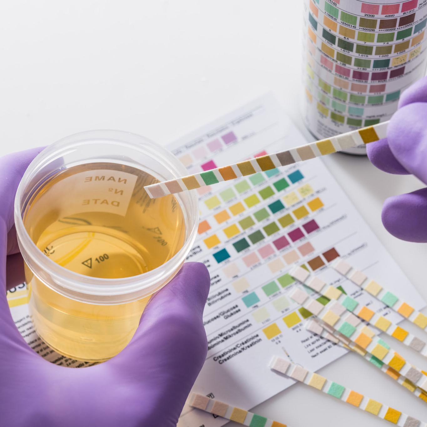 Urinzytologie & Biomarker