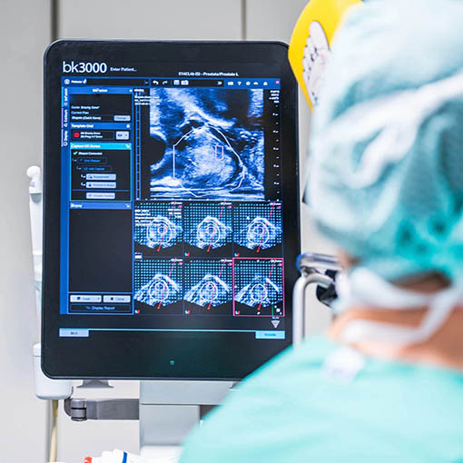 Fusionsbiopsie der Prostata