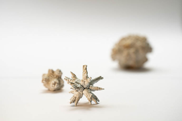 Verschiedene Größen und Formen von Harnsteinen