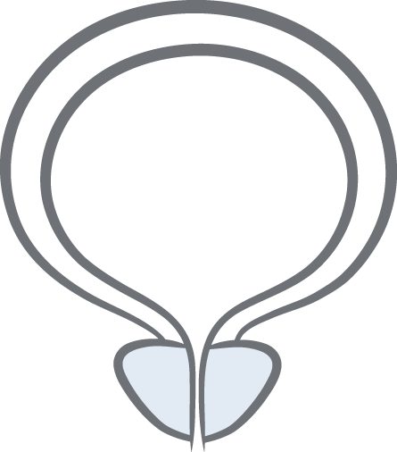 Gutartige Prostatavergrößerung Grafik