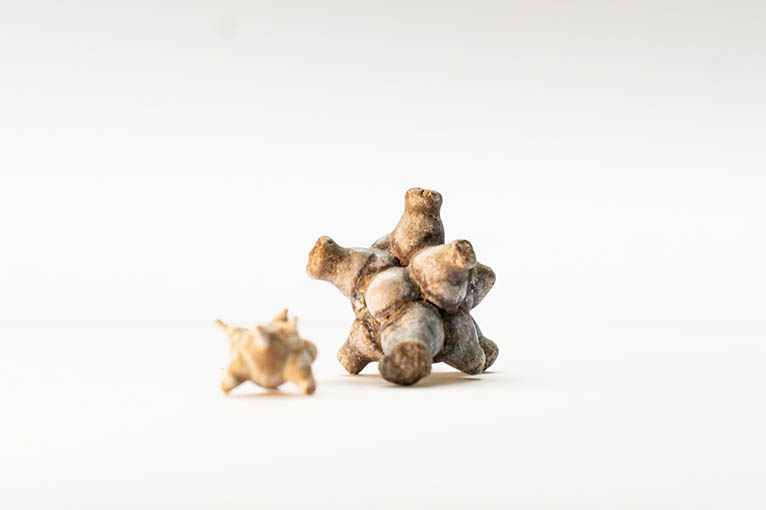 Verschiedene Arten von Harnsteinen