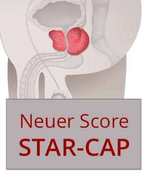 STAR-CAP - Neuer Score für das Prostatakarzinom