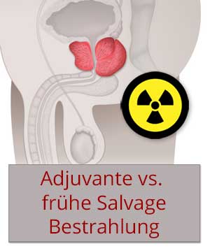 Adjuvante vs. frühe Salvage Bestrahlung 