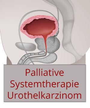 Aktuelle Konzepte der palliativen Systemtherapie bei Urothelkarzinom