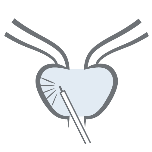 HoLEP Icon