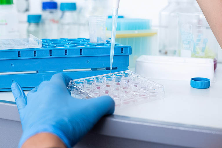 Closeup Labor Tumormarker