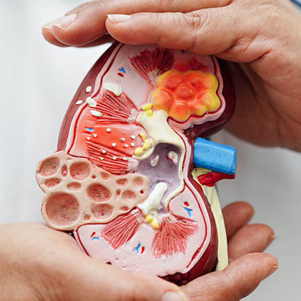 Mpodell einer Niere-Symbolbild Harnsteinzentrum