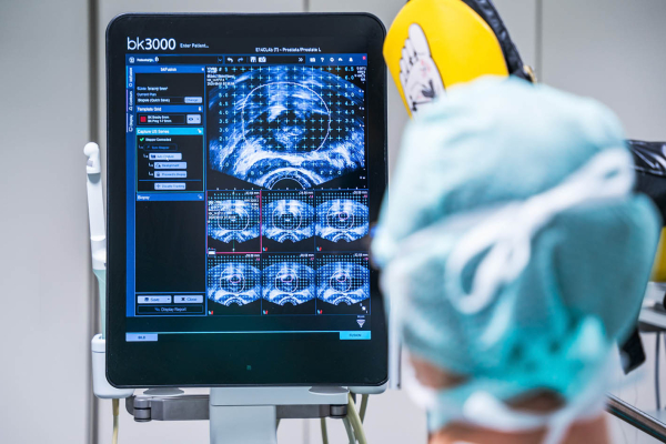 Fusionsbiopsie der Prostata